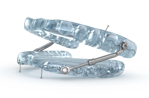 Sleep Apnea Treatment in Sterling Heights, MI | Dr. Pearson
