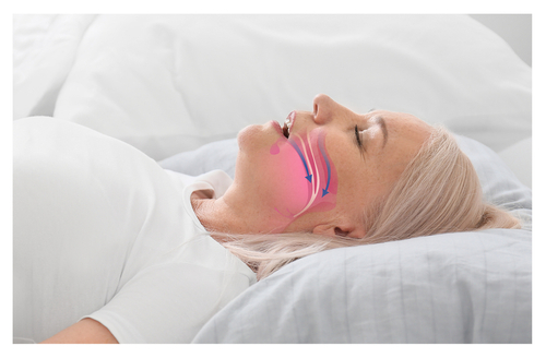 Sleep Apnea Treatment in Sterling Heights, MI | Dr. Pearson