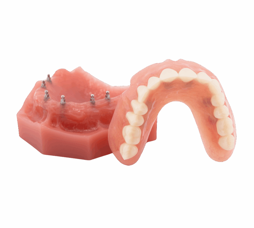 Permanent Implant Dentures in Sterling Heights, MI | Free Consults