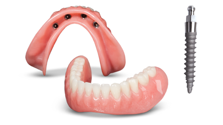 Dentures in Sterling Heights, MI | Schedule a Free Consultation