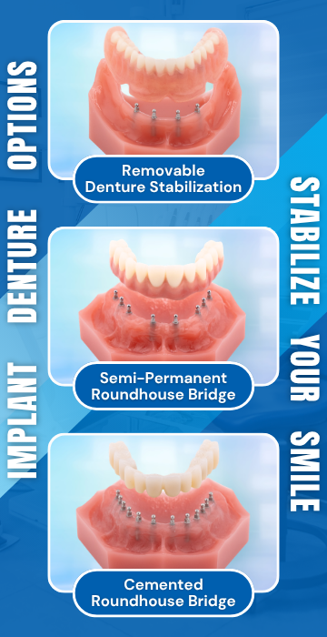 Implant Denture Options in Sterling Heights, MI | Book a Free Consultation