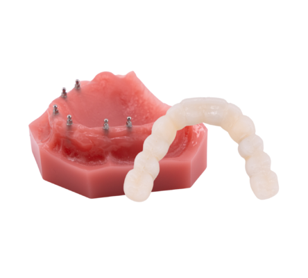 Mini Implants for Dentures [Video Guide] | Free Consultations in MI