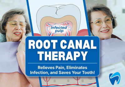 Root Canal Therapy in Sterling Heights, MI | Get Pain Relief Now!