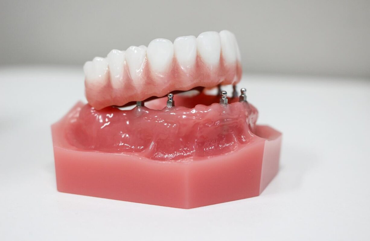 Dental Plate in Sterling Heights, MI | Free Consultations Near Me