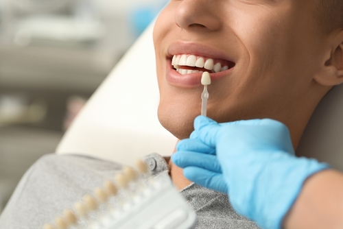 Smile Makeover in Sterling Heights, MI | Using Cosmetic Treatments To Enhance Your Smile