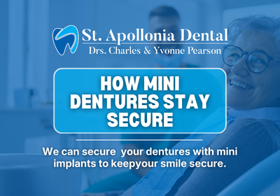 Mini Dentures in Sterling Heights, MI | Book a Free Consultation
