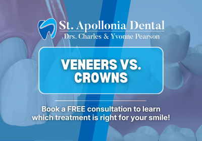 Veneers vs. Crowns in Sterling Heights, MI | Free Consultations